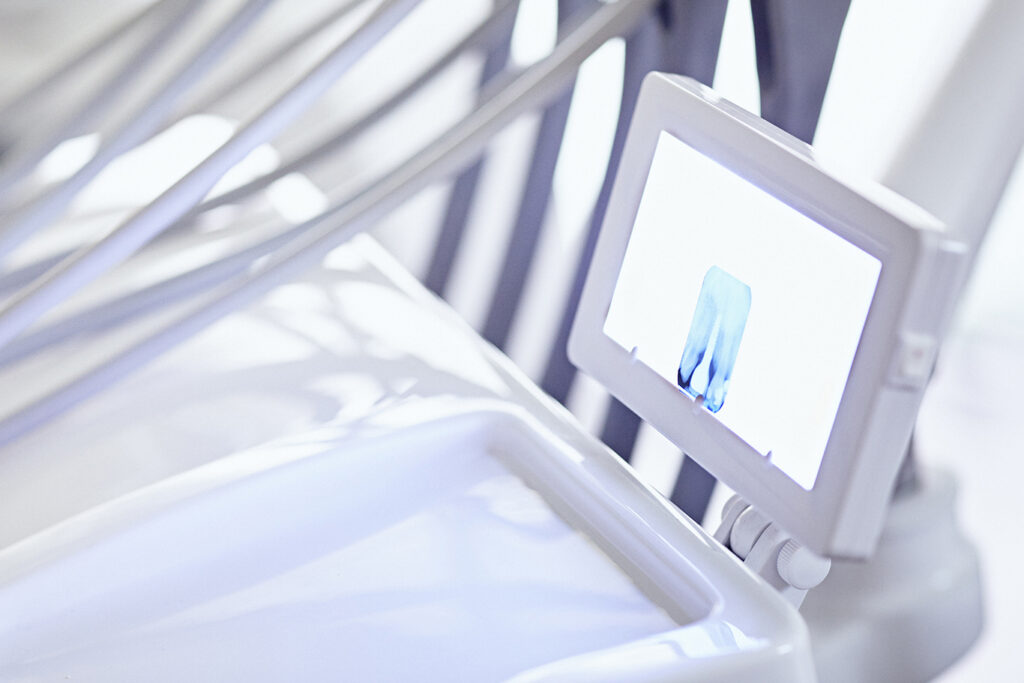 teeth x-ray