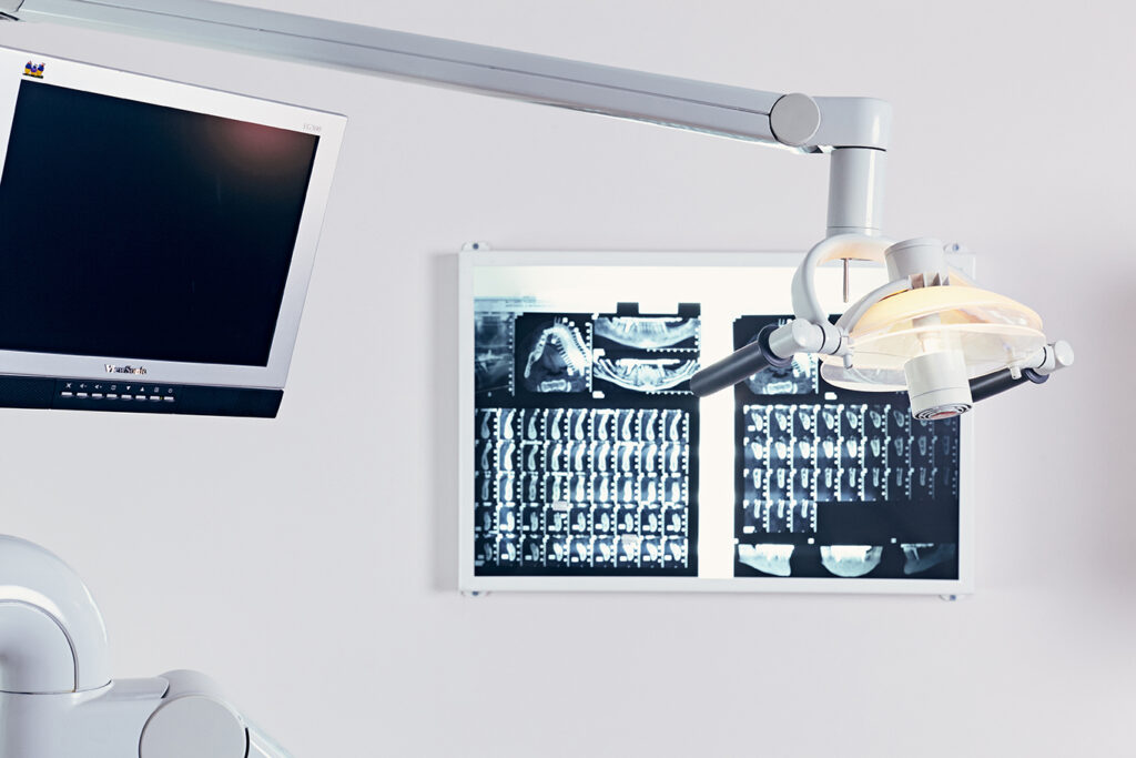 dental x-rays